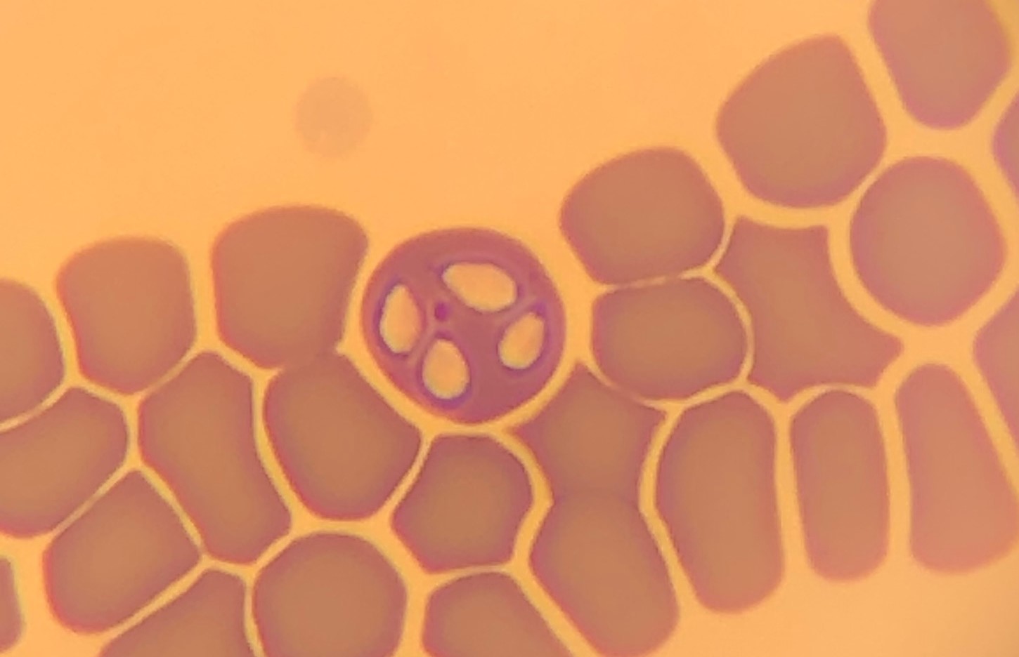 Bosluiskoorsorganismes in die rooibloedselle