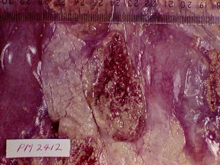 Ontsteking van die plasenta met brusellose
