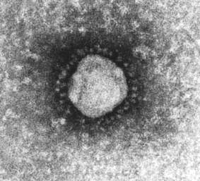 A typical Coronavirus particle