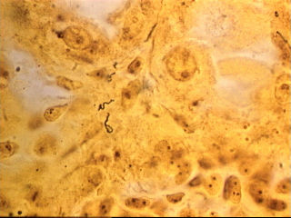 Leptospirose-organismes in 'n nier