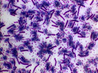 Miltsiektebakterieë onder die mikroskoop